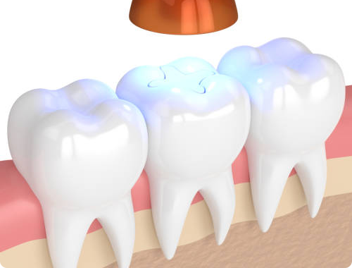 About care teeth