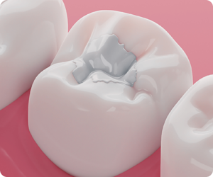 About care teeth