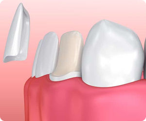 About care teeth