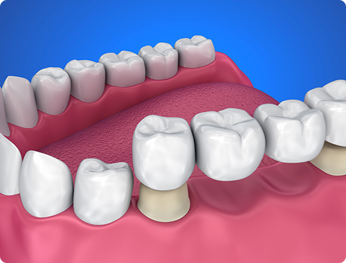 About care teeth