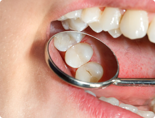 About care teeth