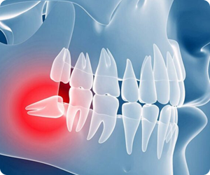 About care teeth